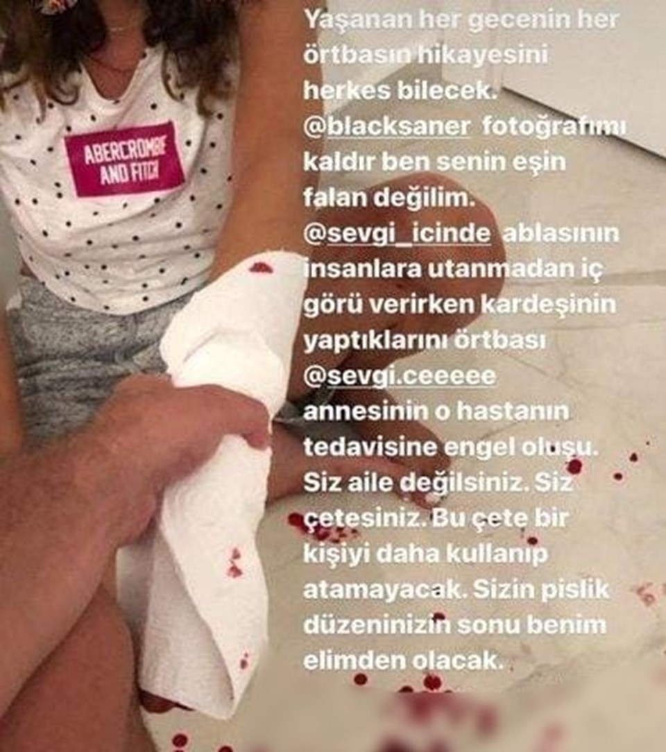 Şiddet gördüğü fotoğrafları sosyal medyadan paylaşan İrem Ay'dan tedbir kararı - 1