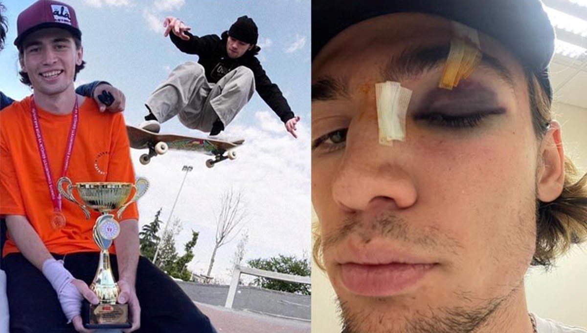 İstanbul'da milli sporcuya dayak