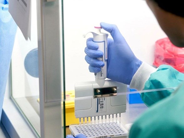 Ozel Hastaneler Icin Yeni Odeme Modeli Pcr Testi Sonucu Pozitif Cikan Hastanin Tedavisi Icin Devletten Odenek Alinabilecek Ntv