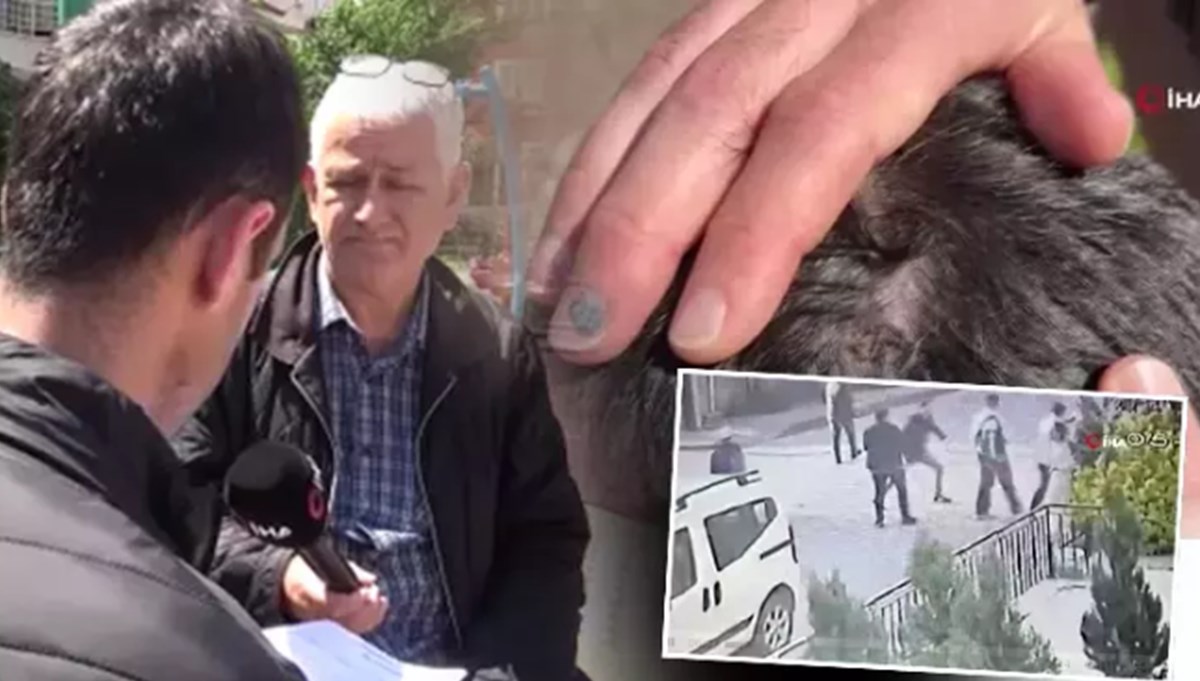 Bekçi ile boksör arasında pitbull kavgası Bekçi ile boksör arasında pitbull kavgası