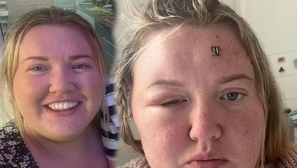 Baş ağrısı şikayetiyle doktora giden kadın gerçeği öğrenince hayatının şokunu yaşadı