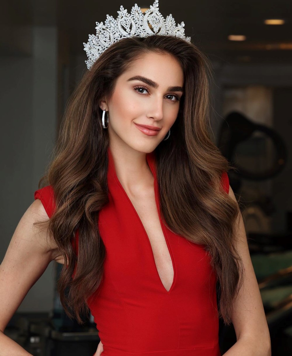 Miss Turkey birincisi İdil Bilgen'in son hali tartışma yarattı - 3
