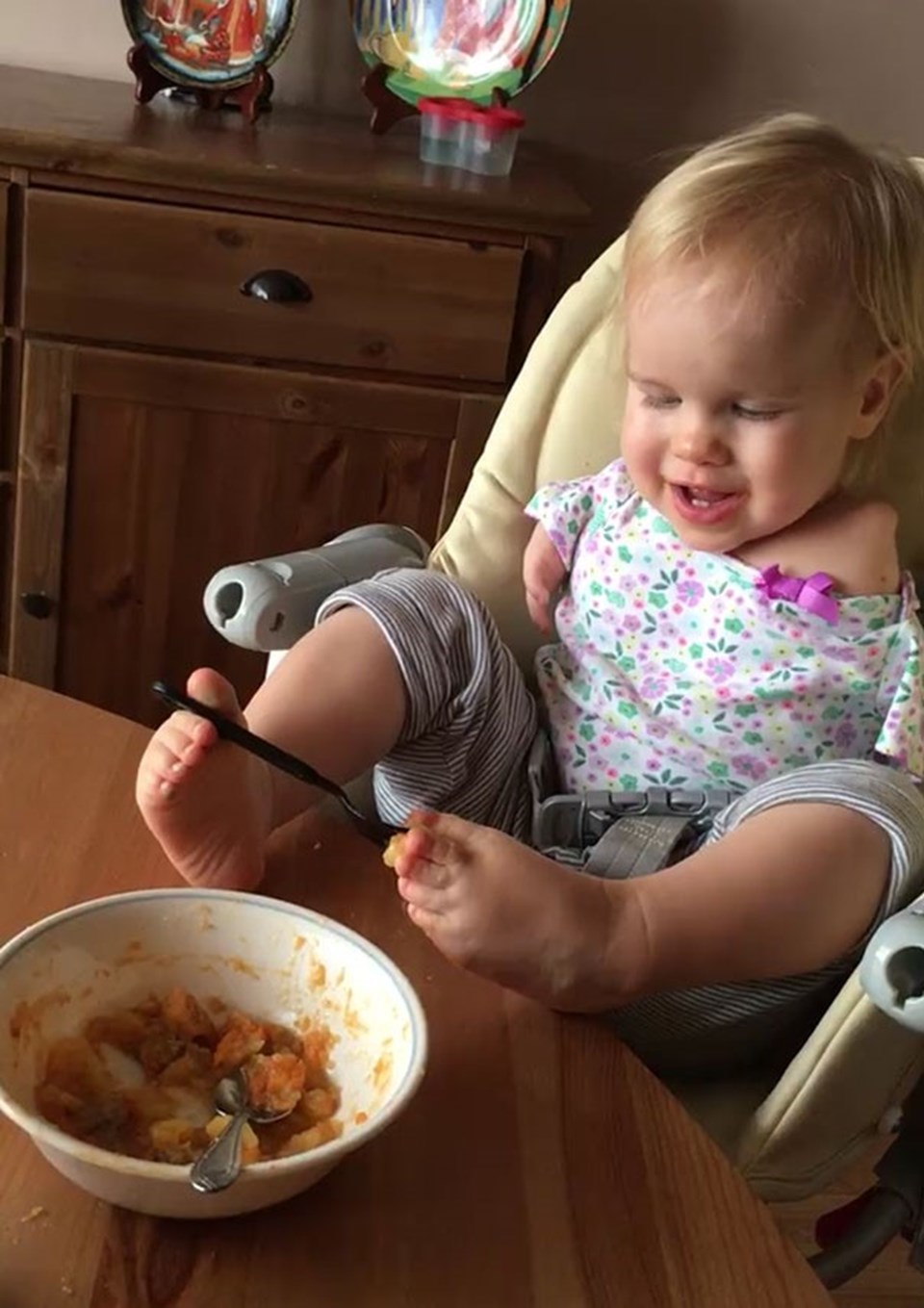 Kolları olmayan bebek ayaklarıyla yemek yemeyi öğrendi - 1