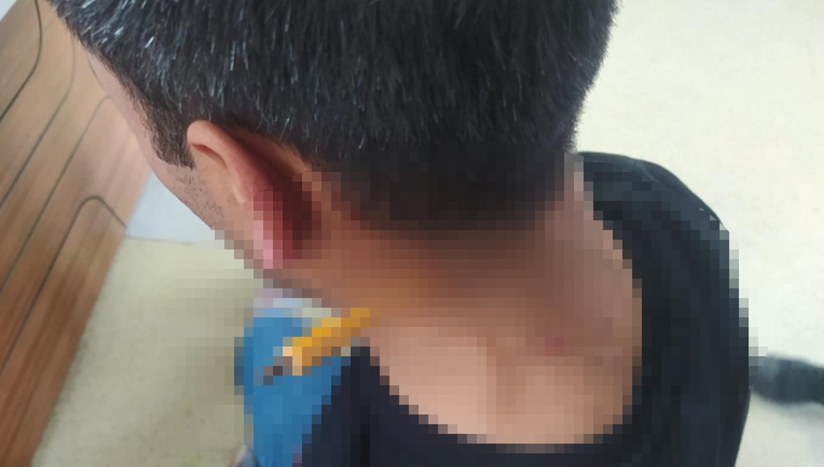 Esenyurt’ta park yeri kavgası: Boynuna tornavida sapladı Esenyurt’ta park yeri kavgası: Boynuna tornavida sapladı