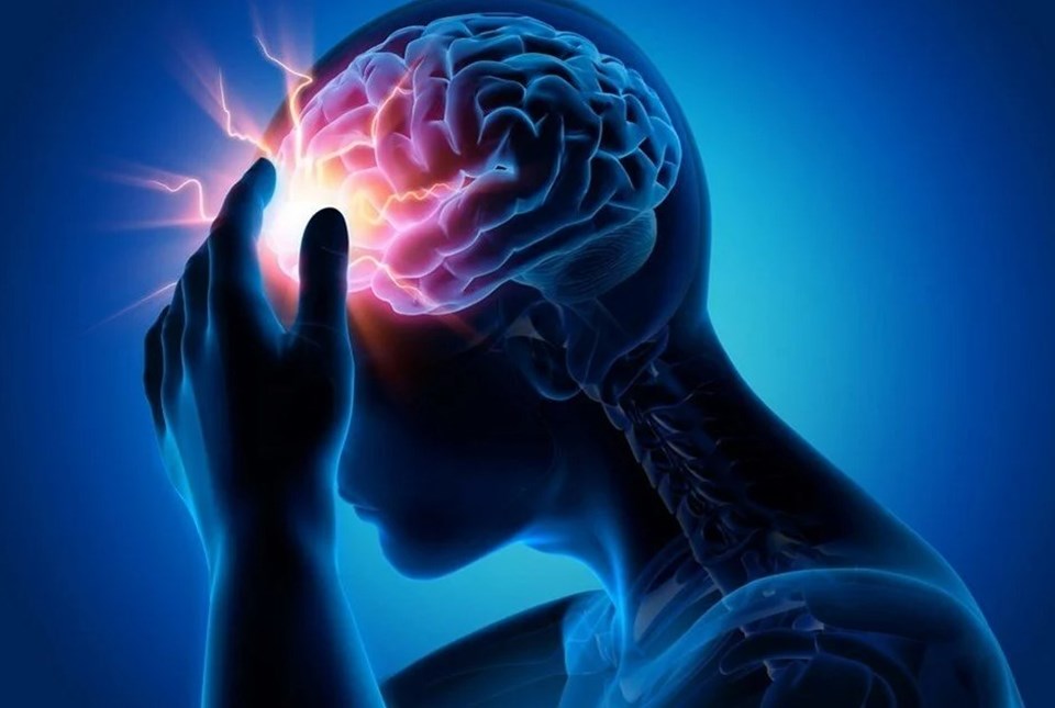 Araştırma: Hastanede yatan Covid hastalarının yüzde 80'i nörolojik semptom gösteriyor - 1