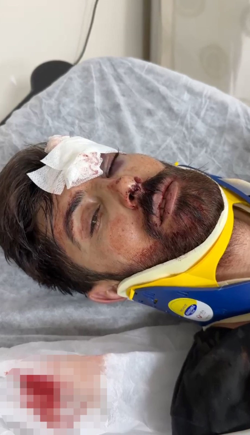 Çiçekçiyi tek yumrukla öldüren şüphelinin ifadesi ortaya çıktı!