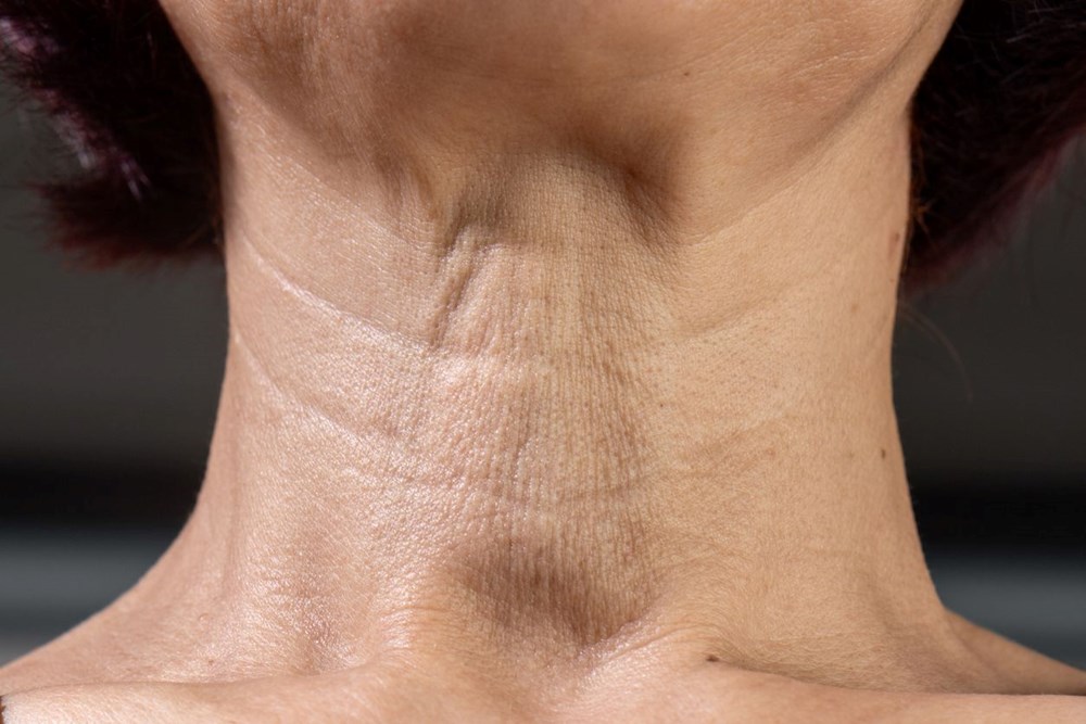 40'lı Yaşlara Merhaba Demeden Boyun Çizgilerine Veda: Pürüzsüz Bir Boyun İçin İpuçları 77