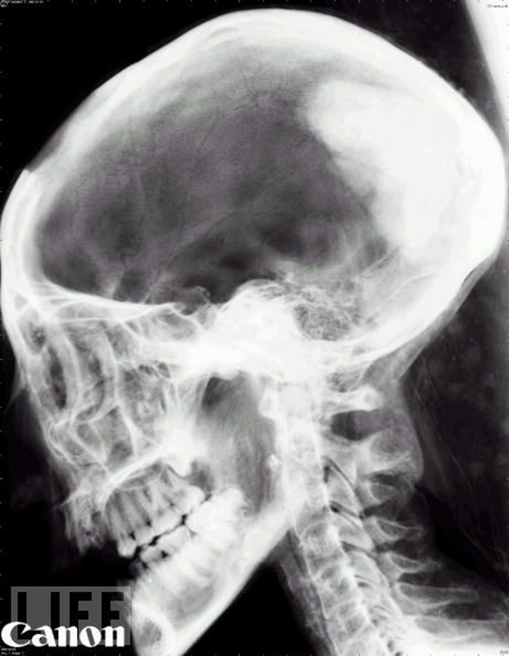 Hayatın röntgeni NTV Hayatın röntgeni NTV