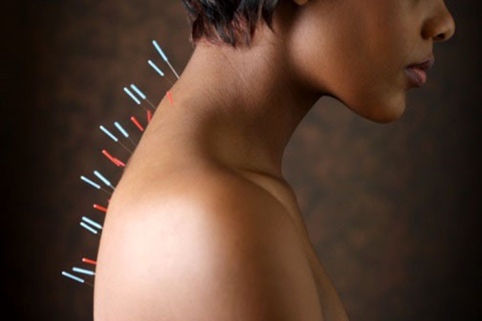 "Akupunktur kanser tedavisinde yan etkileri azaltıyor" - 1