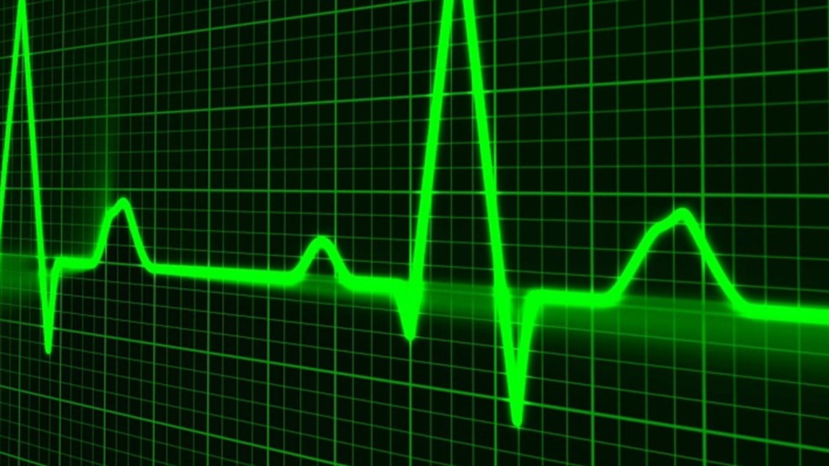 Kalp Atisinizi Hissediyorsaniz Dikkat Saglik Haberleri Ntv