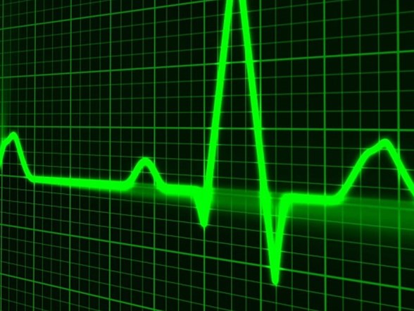 Kalp Atisinizi Hissediyorsaniz Dikkat Saglik Haberleri Ntv