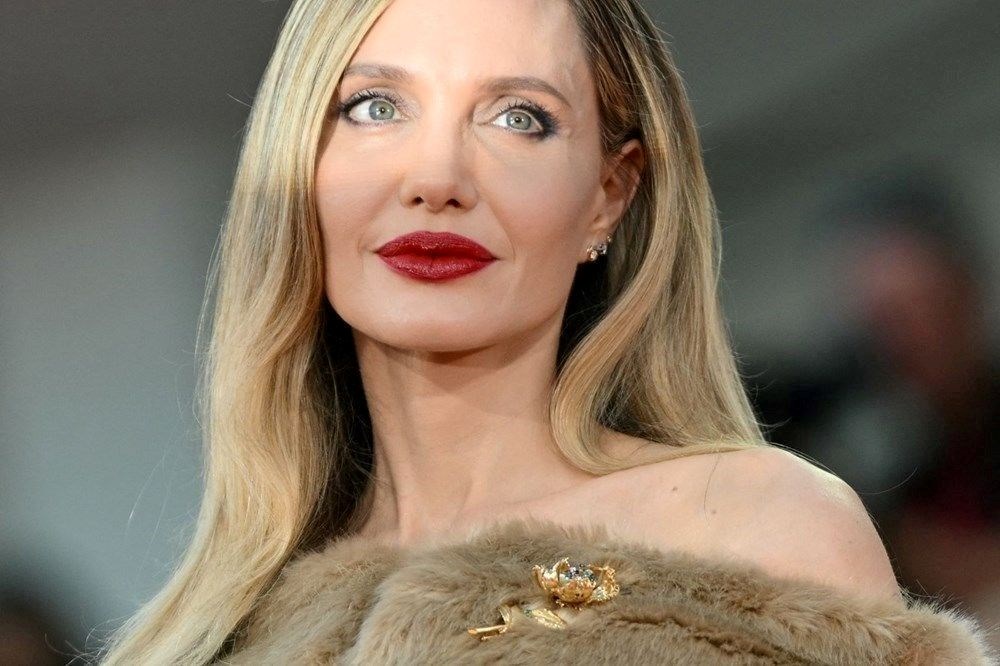 Angelina Jolie ile Brad Pitt'in oğlu yine kaza geçirdi: Bu sefer ucuz atlattı! - 9