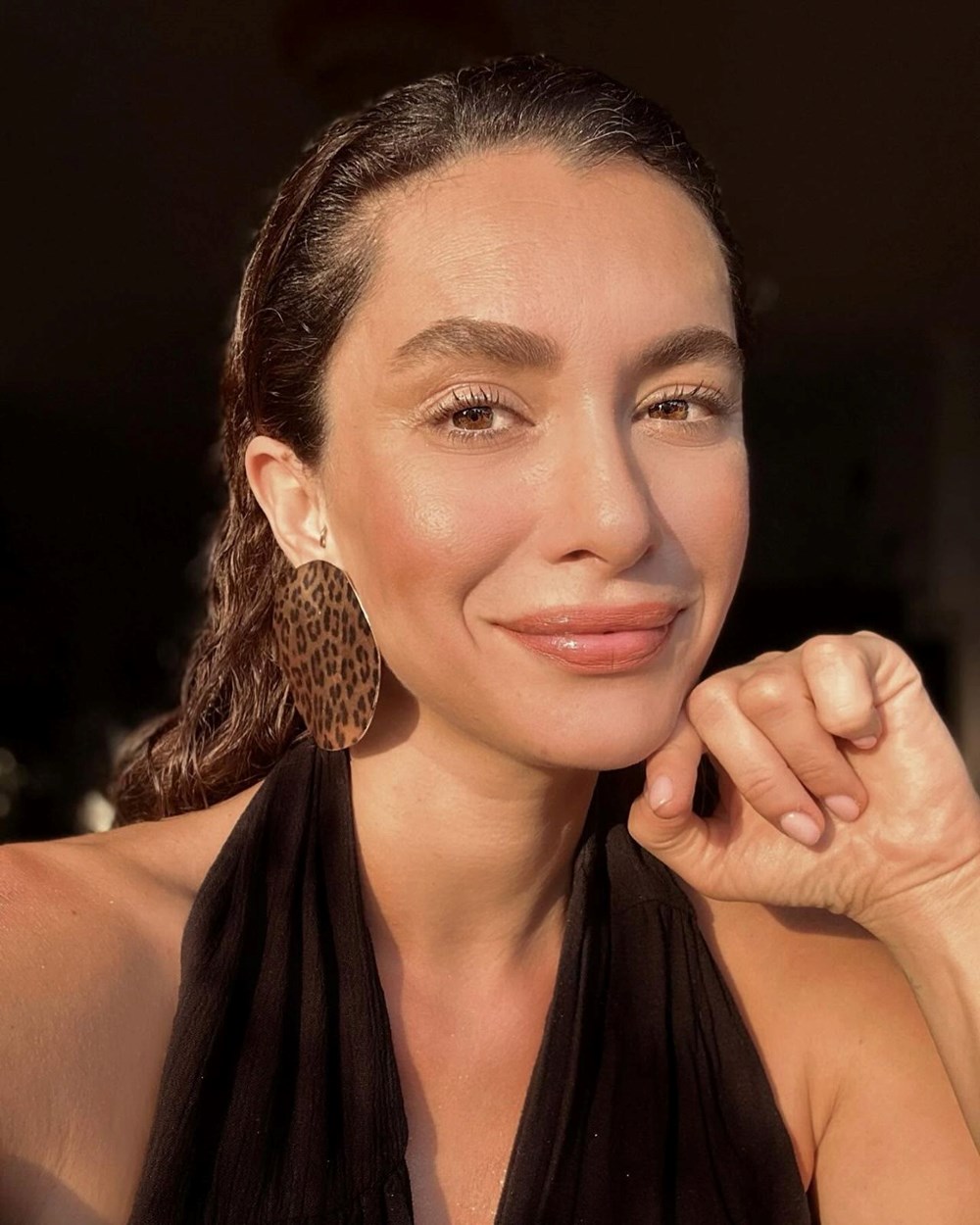 Hande Doğandemir'in kaburga kemiği kırıldı - 2