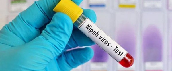 Hindistan'daki Nipah virüsü salgınında ölenlerin sayısı 12'ye çıktı