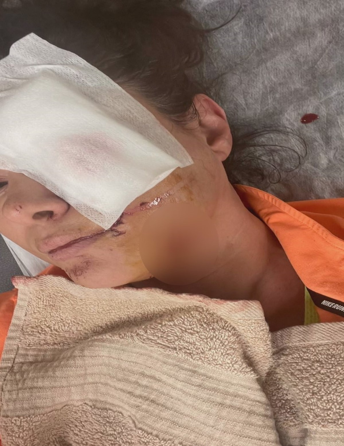 Şarkıcı Tuğba Altıntop'a köpek saldırdı: Yüzüne dikiş atıldı - 1