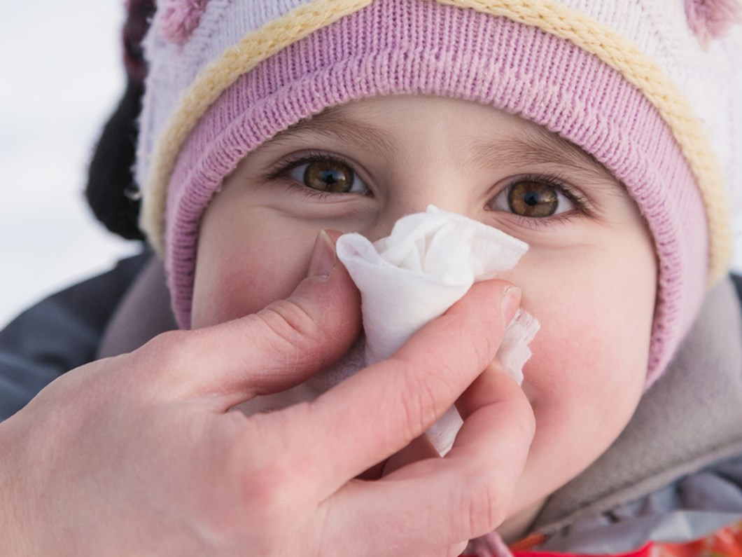 Burun Kanamasi Ne Zaman Tehlikeli Olur Saglik Haberleri Ntv