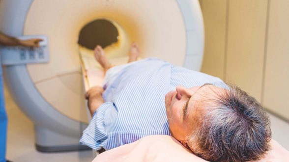 Prostat Kanserinden Koruyan 5 Altin Kural 6 Erkekten Biri Prostat Kanseri Saglik Haberleri Ntv