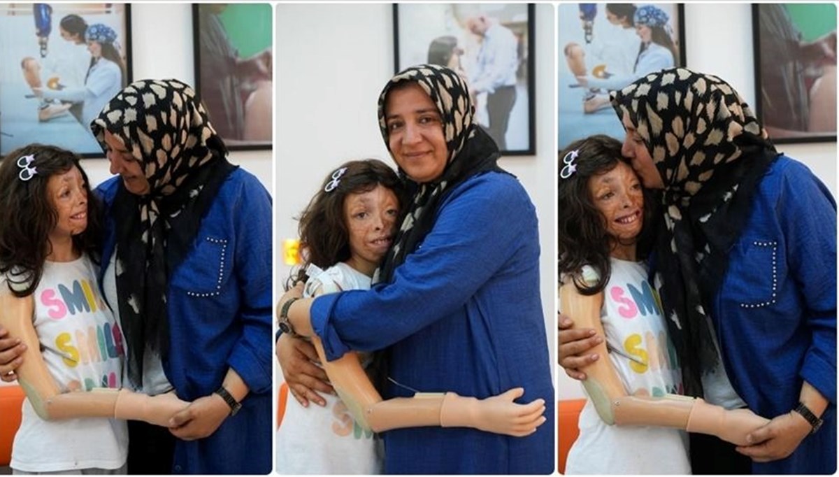 Saçlarının ardından protez koluna kavuştu: Her şeye meydan okuyor, ressam olmak istiyor Saçlarının ardından protez koluna kavuştu: Her şeye meydan okuyor, ressam olmak istiyor