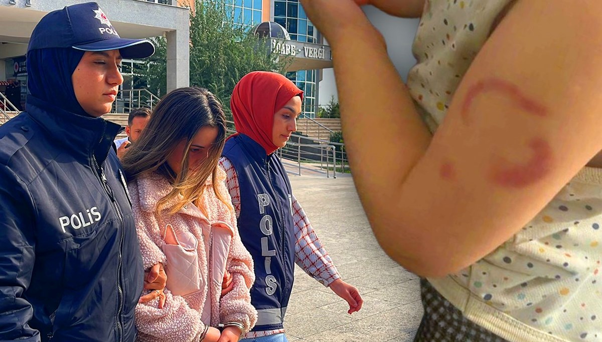 Bebeği ısıran bakıcı için karar verildi Bebeği ısıran bakıcı için karar verildi