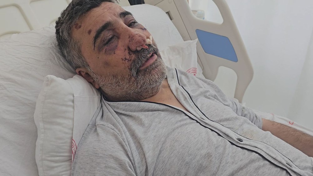 İngiliz boksörün komalık ettiği taksici yoğun bakımdan çıktı, yaşananları anlattı: Öptü, ısırdı, elini gözüme soktu - 7