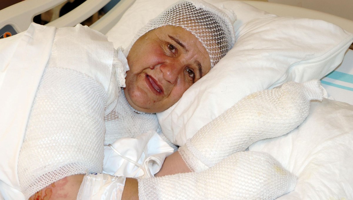 Ekmek pişirirken tandıra düştü