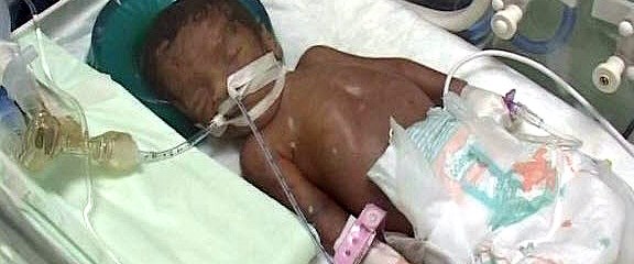 Mucize bebek kurtarılamadı NTV