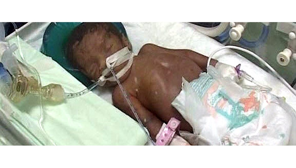 Mucize bebek kurtarılamadı NTV Mucize bebek kurtarılamadı NTV