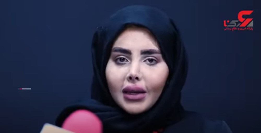 Zombi Angelina gerçek yüzünü paylaştı: Hiç estetik yaptırmadım - 6