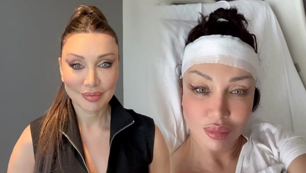 Alın daraltma ameliyatı olan Umut Akyürek son halini paylaştı - Son Dakika  Magazin Haberleri | N-Life