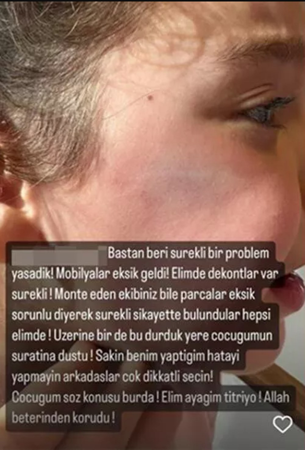 Berkay Şahin ve Özlem Ada Şahin'in çocuğu yaralandı - 2