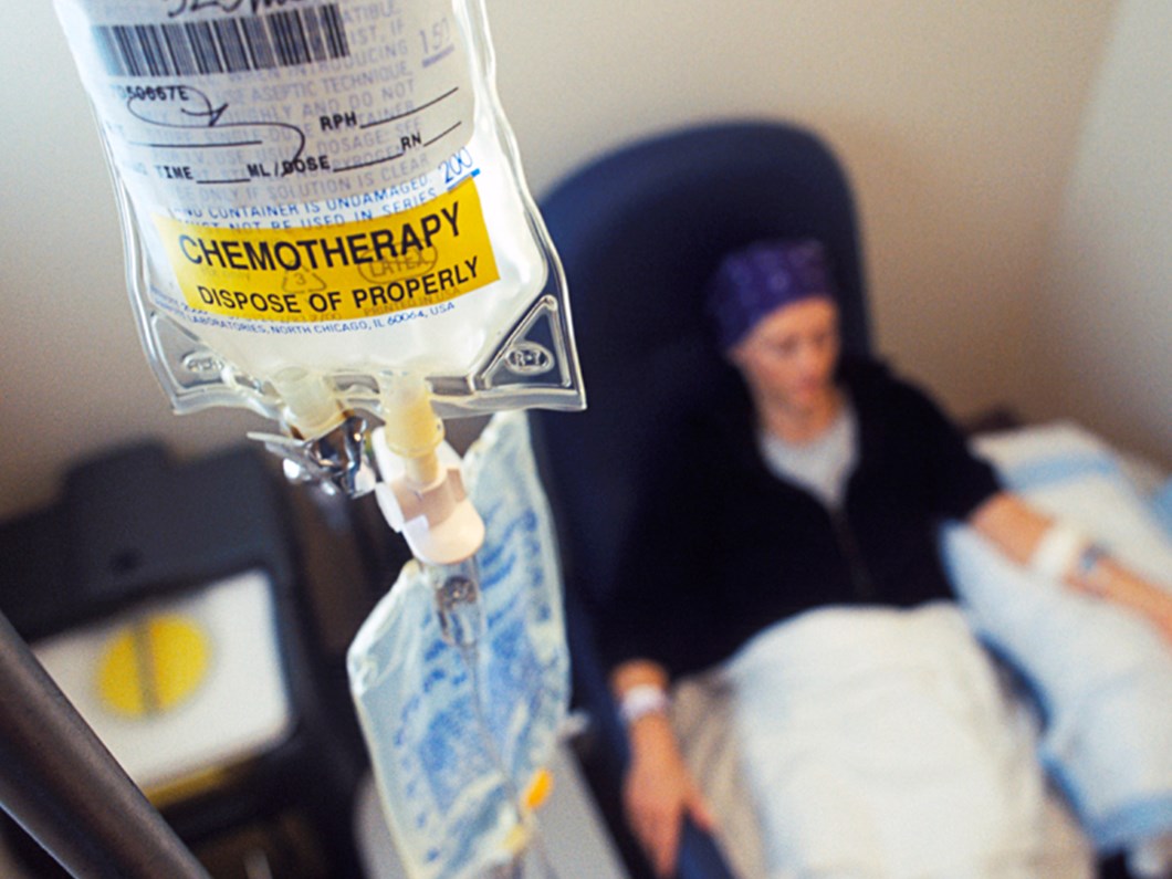kemoterapi oldurur mu kemoterapiyi kim yapmali