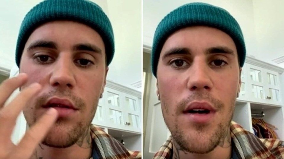 Justin Bieber dünya turnesini tamamen iptal etti - 1