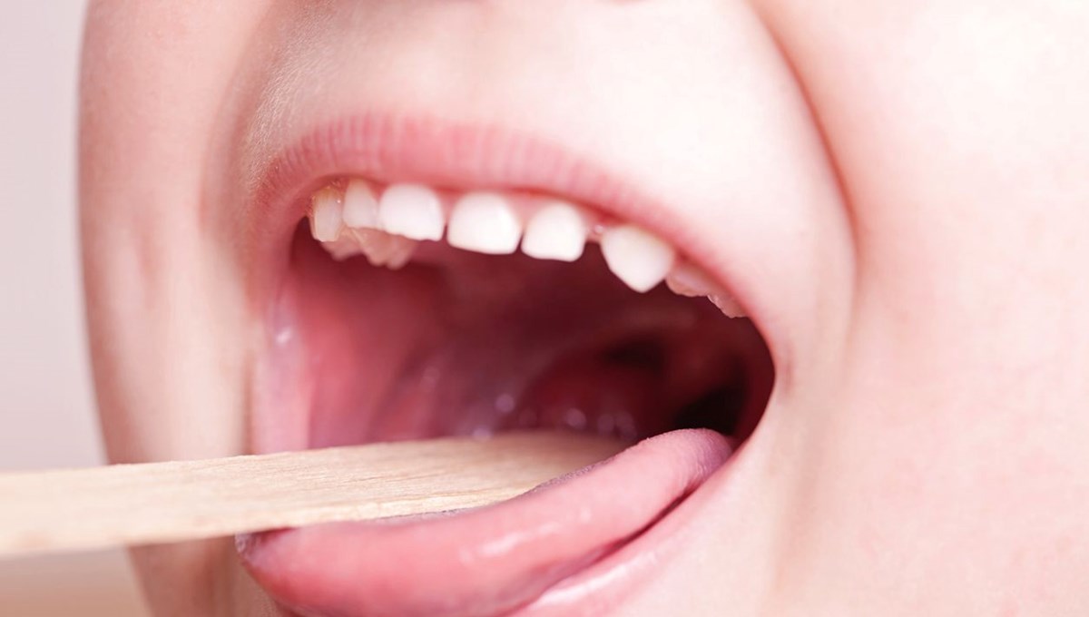 3 belirtiyle doktora gitti, bademcik iltihabı dediler: 5 yaşındaki kız 12 saat sonra hayatını kaybetti 3 belirtiyle doktora gitti, bademcik iltihabı dediler: 5 yaşındaki kız 12 saat sonra hayatını kaybetti