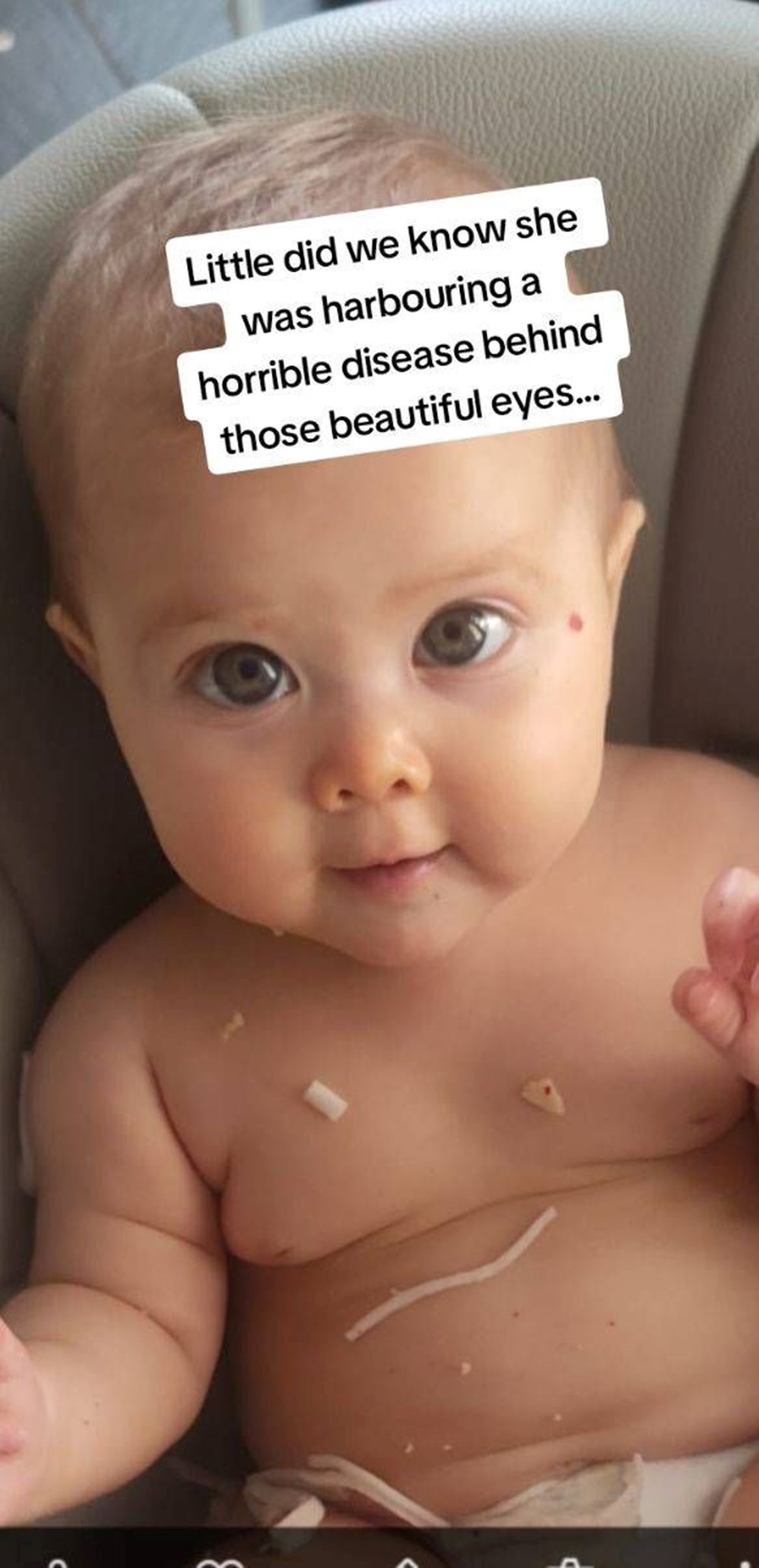 Dünyada nadir görülen hastalık: 21 aylık bebek kan ağlıyor! - 4