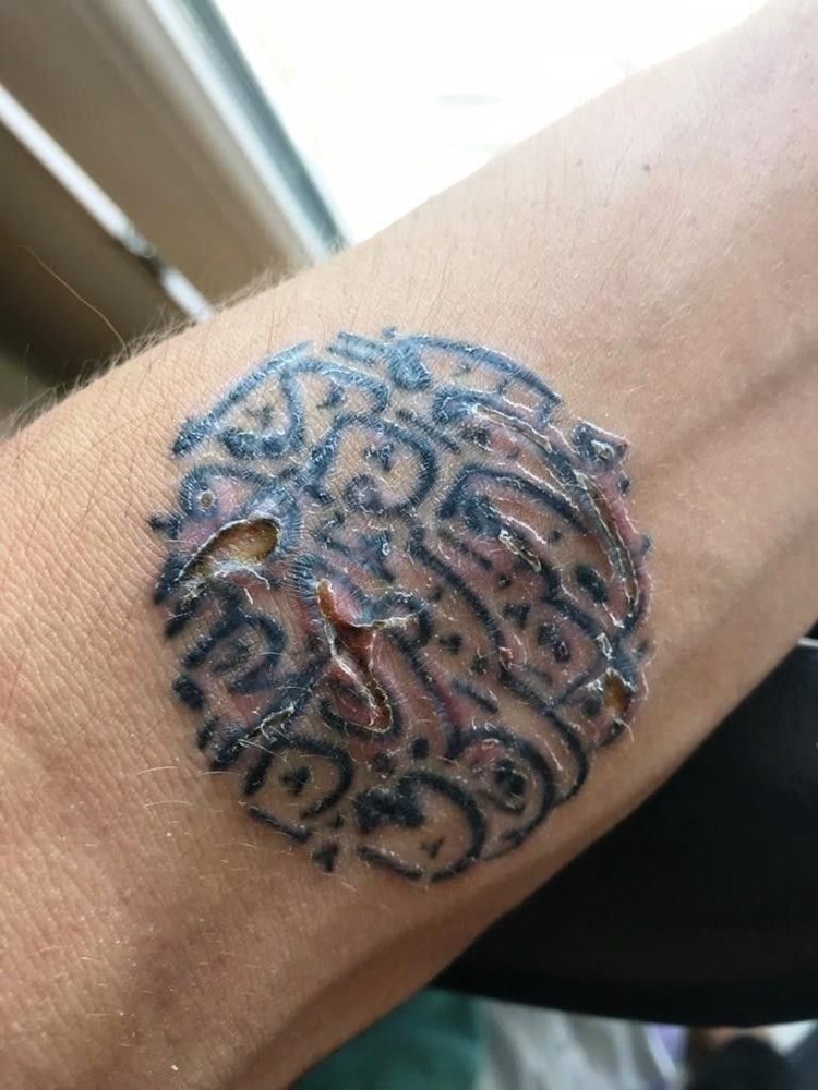 Sildirmek Istedigi Dovmeler Kabusu Oldu Magazin Haberleri Ntv