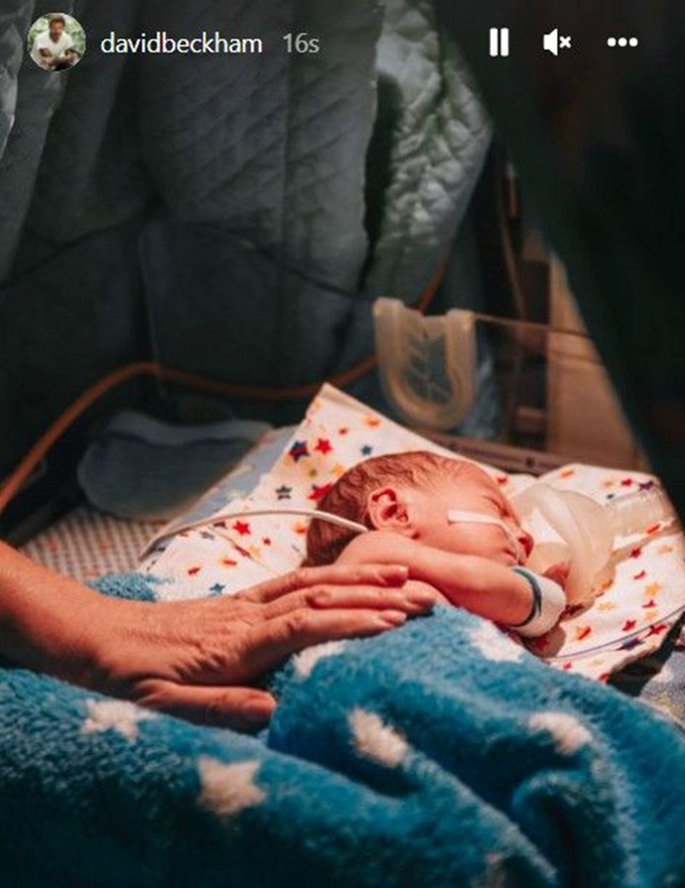 David Beckham 71 milyon takipçili Instagram hesabını Ukraynalı doktora verdi - 5