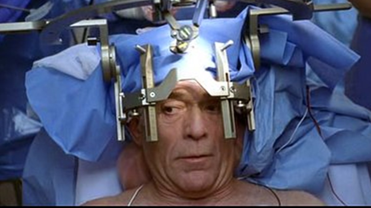 ameliyatin ortasinda uyaniyorlar anestezi farkindaligi nedir saglik haberleri ntv