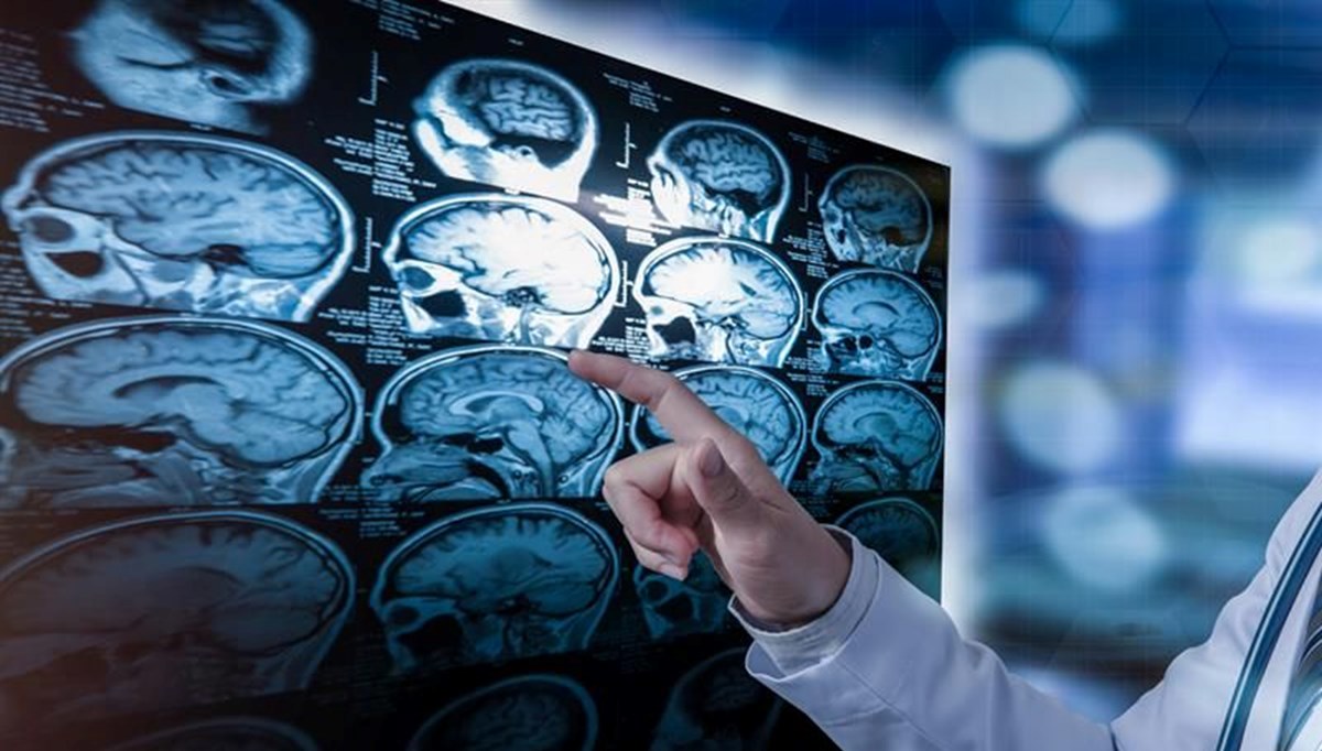 Beyin, aynı anıyı her seferinde farklı kaydediyor