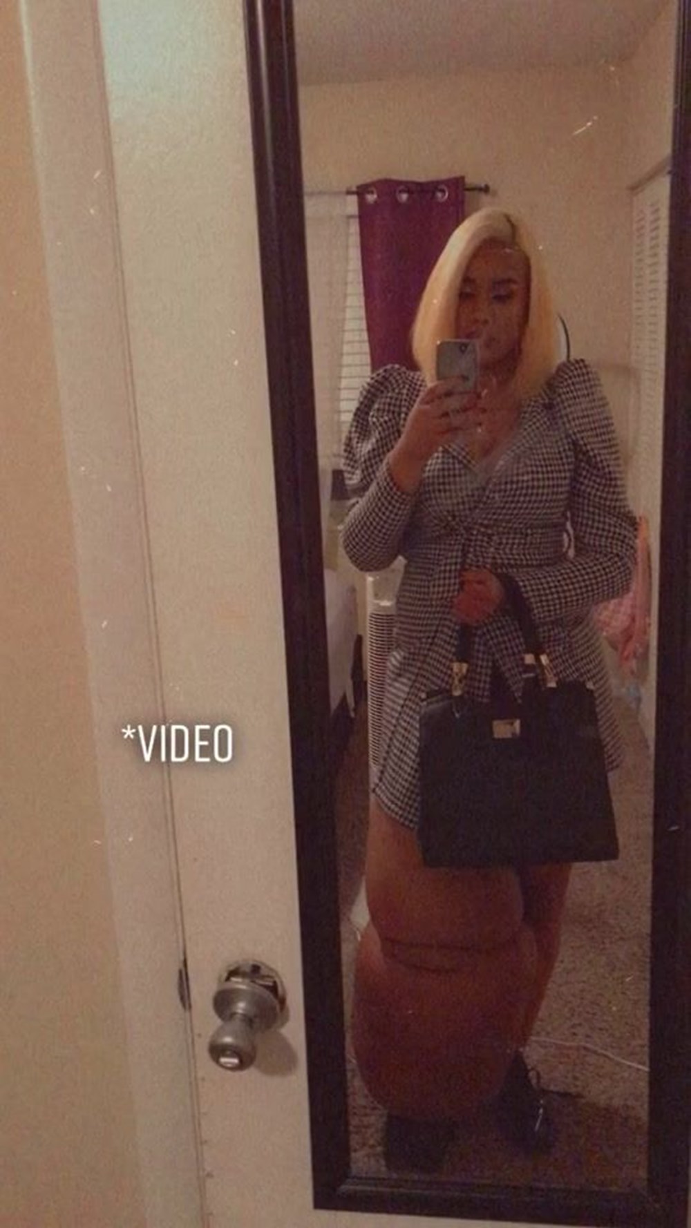 Doğuştan lenfödemili (fil hastalığı) Mahogany Geter acımasız eleştirilere rağmen görünüşüyle barışık yaşıyor - 6