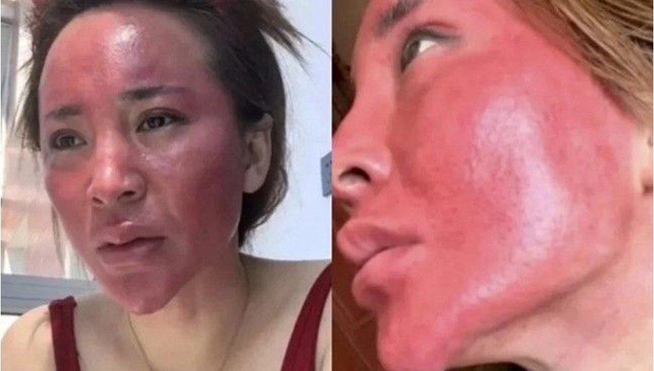 22 yıldır makyajını temizlemeyen kadının yüzü tanınmaz hale geldi