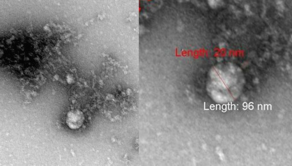 Corona virüsün mutasyonu ilk kez görüntülendi