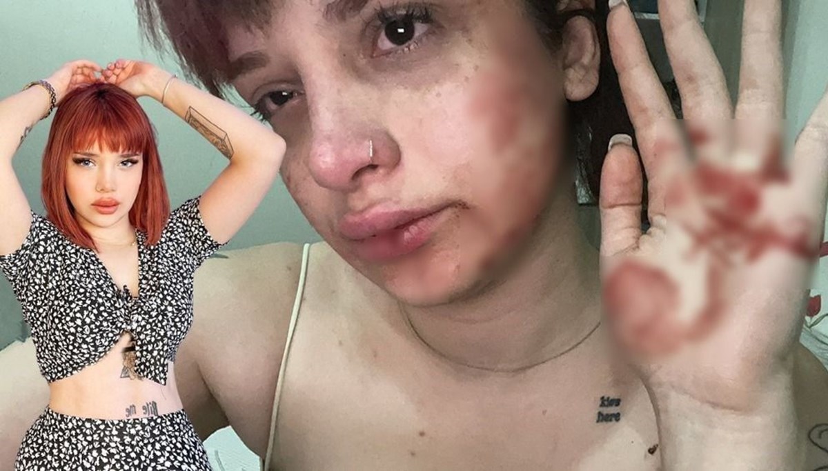 Sosyal medya fenomeni Başak Ermiş'e oyuncu Can Topçu'dan 'tayt' dayağı