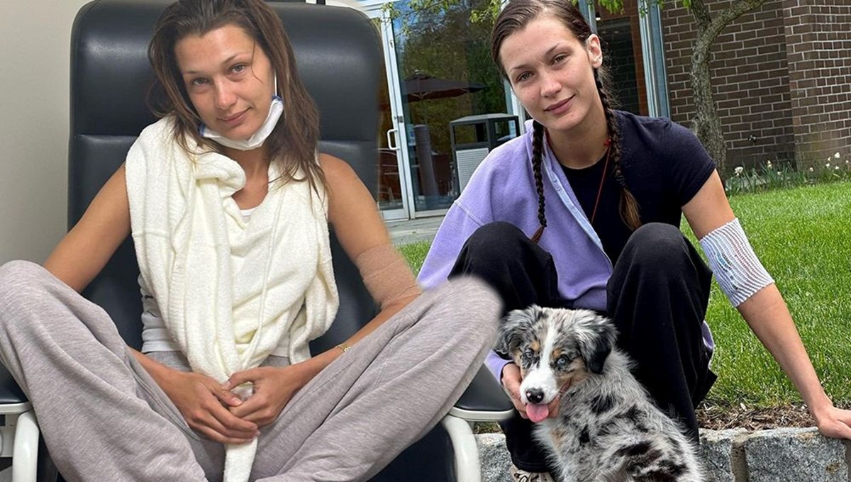 Lyme hastalığıyla mücadele eden Bella Hadid tedavi sürecini paylaştı Lyme hastalığıyla mücadele eden Bella Hadid tedavi sürecini paylaştı