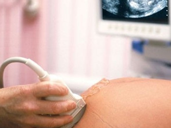 sezaryen solunum sikintisi yaratiyor saglik haberleri ntv