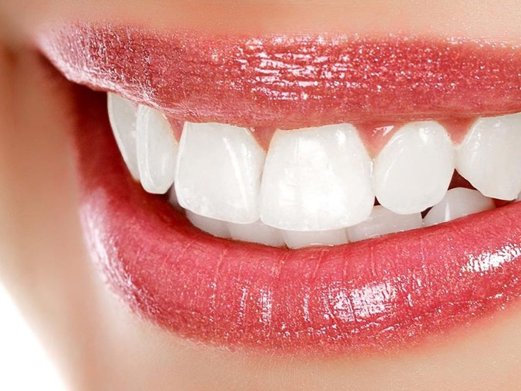 Dis Beyazlatmak Icin Limon Ve Karbonat Kullanmayin Saglik Haberleri Ntv