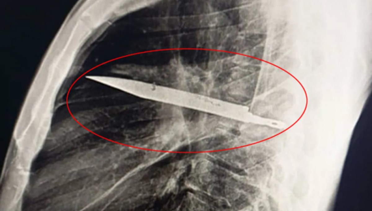 8 yıl bıçakla yaşamış