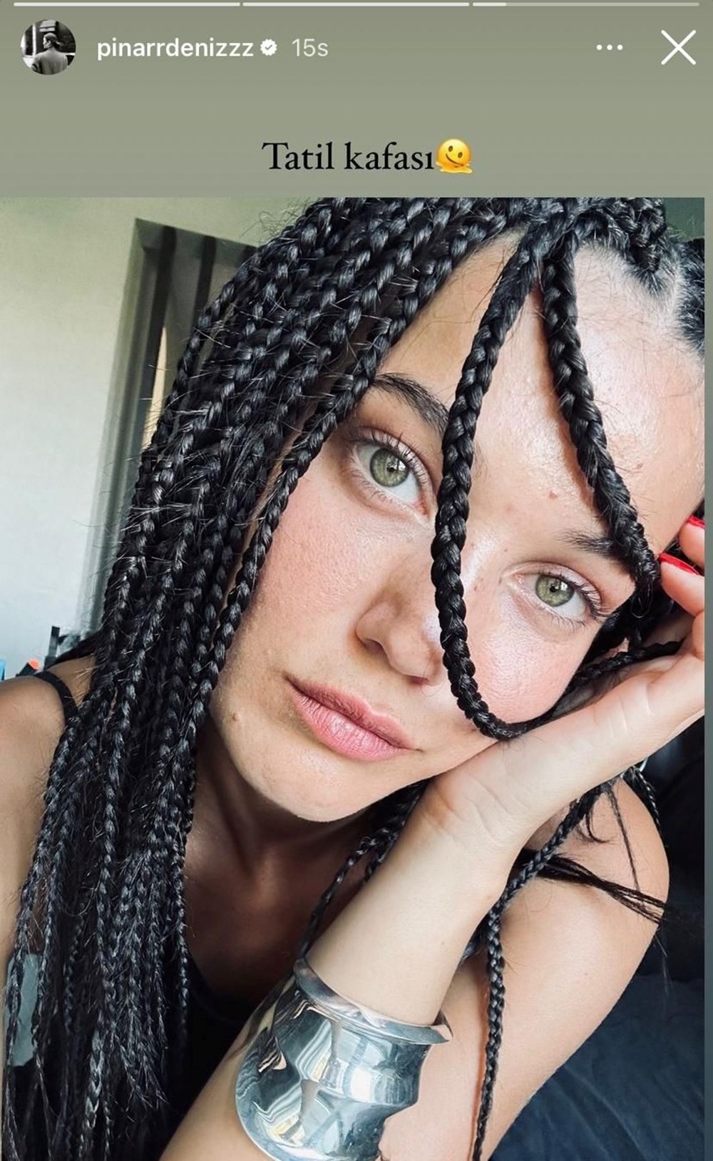 Birce Akalay saçlarını kısacık kestirdi! (Ünlülerin değişimi) - 33