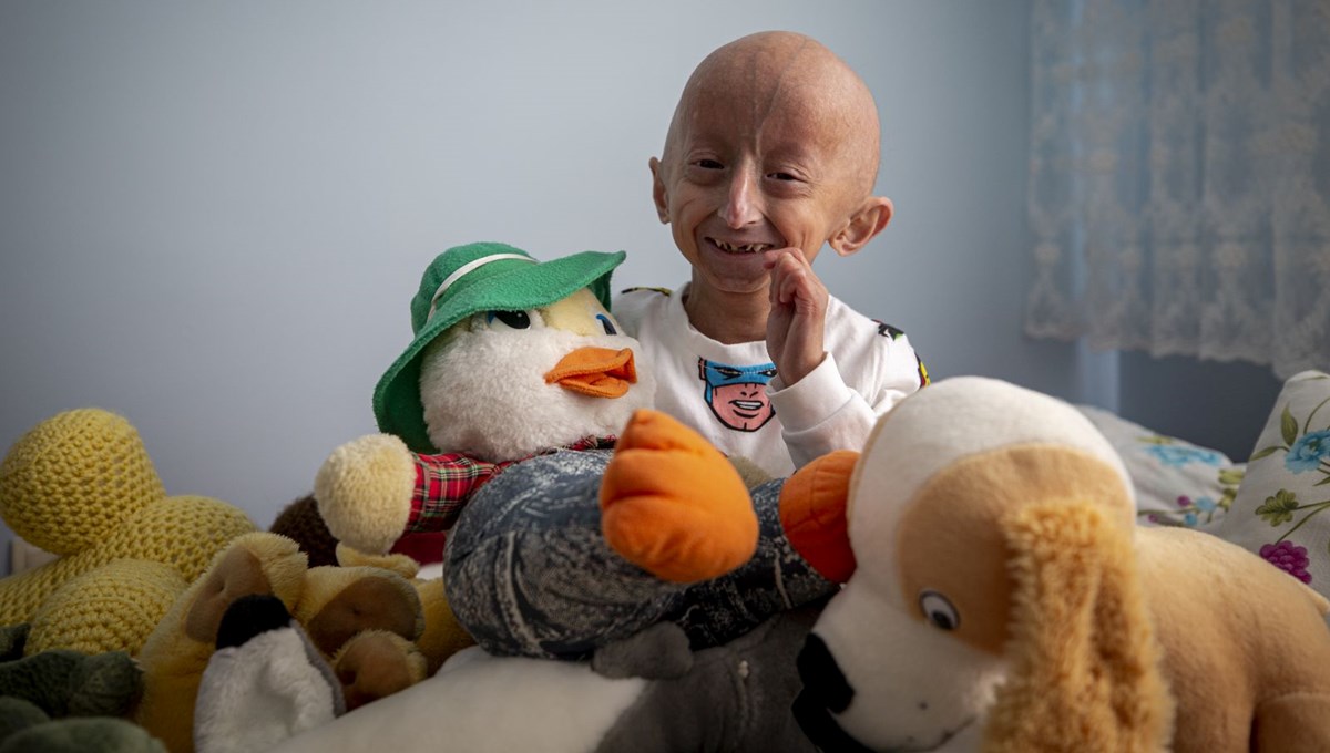 9 yaşındaki Veysel'in erken yaşlanma hastalığı ile mücadelesi