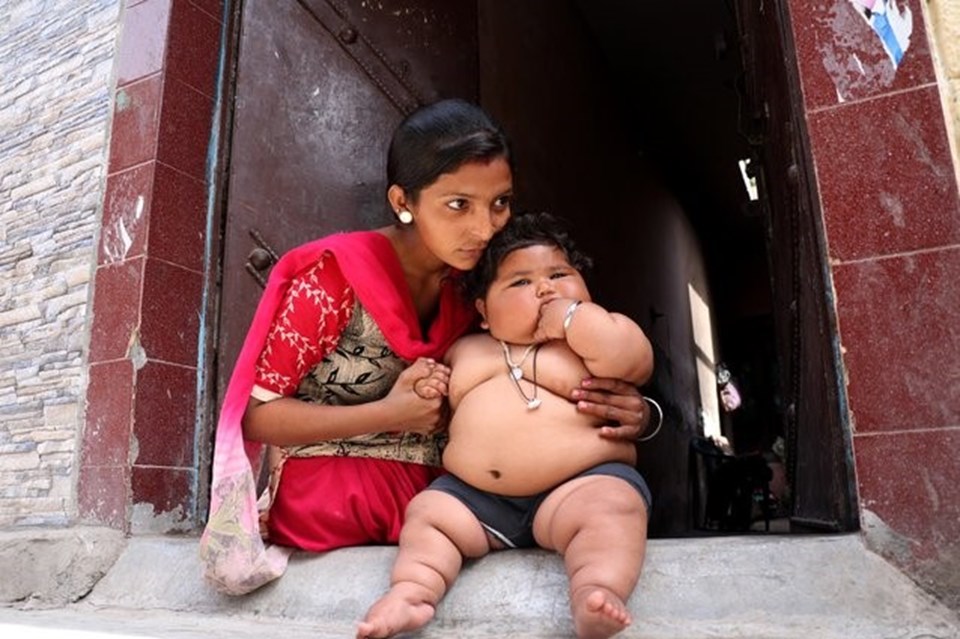 Görenler şaşırıyor, 8 aylık Chahat Kumar bebek 17 kilo! - 1