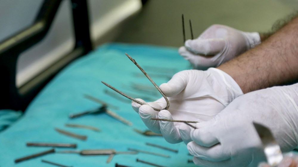 Van'da kadın hastanın midesinden 158 yabancı cisim çıkarıldı - 2